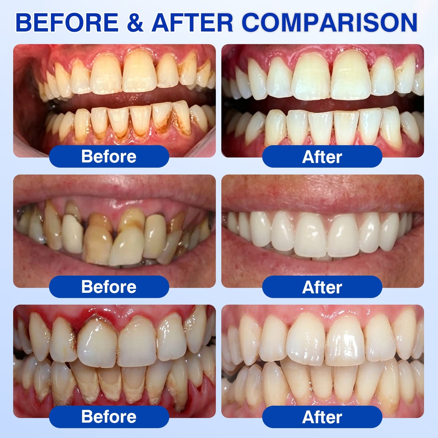us👨‍⚕️✅🦷 Moragoon® Gum Protect Periodontal Repair Gel