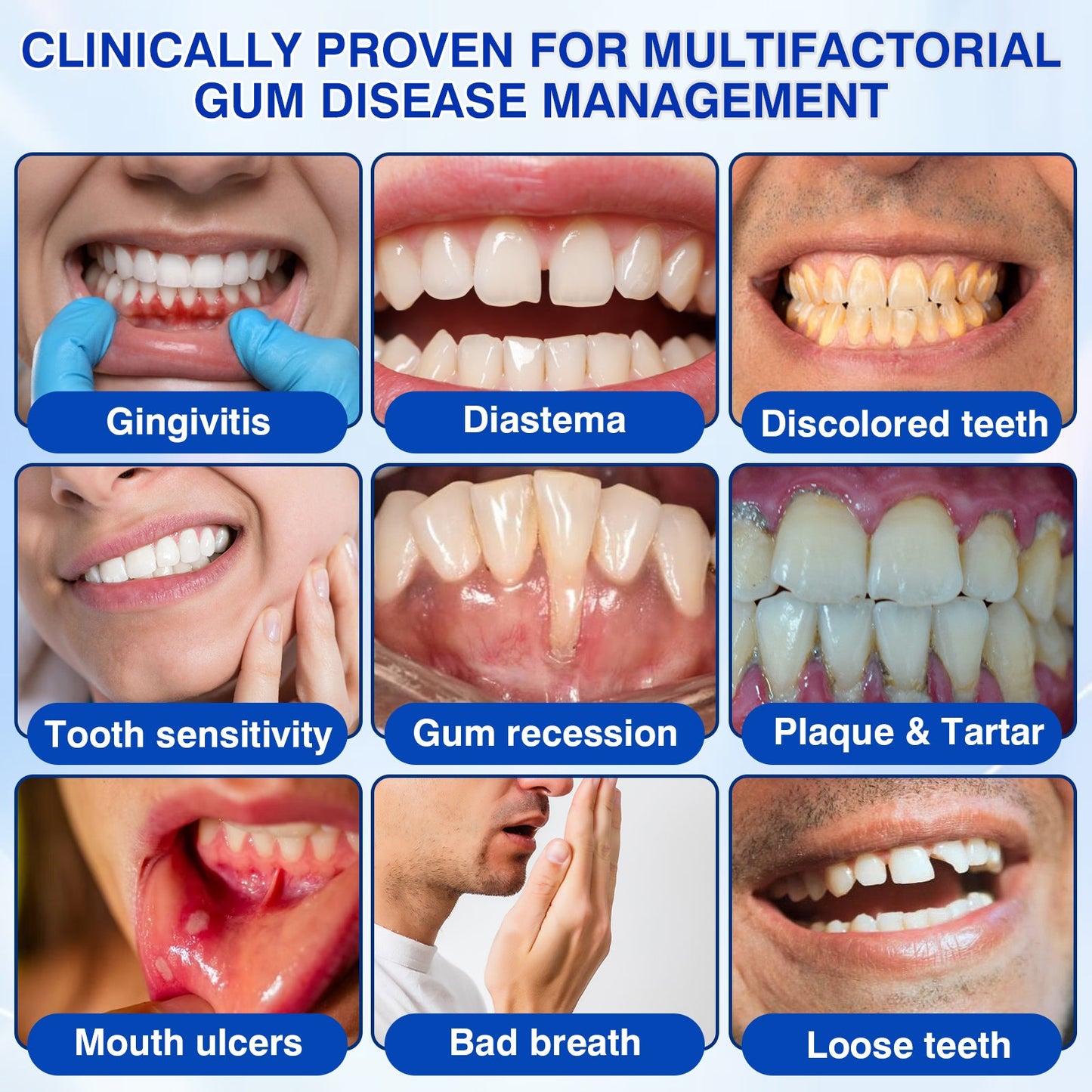 us👨‍⚕️✅🦷 Moragoon® Gum Protect Periodontal Repair Gel