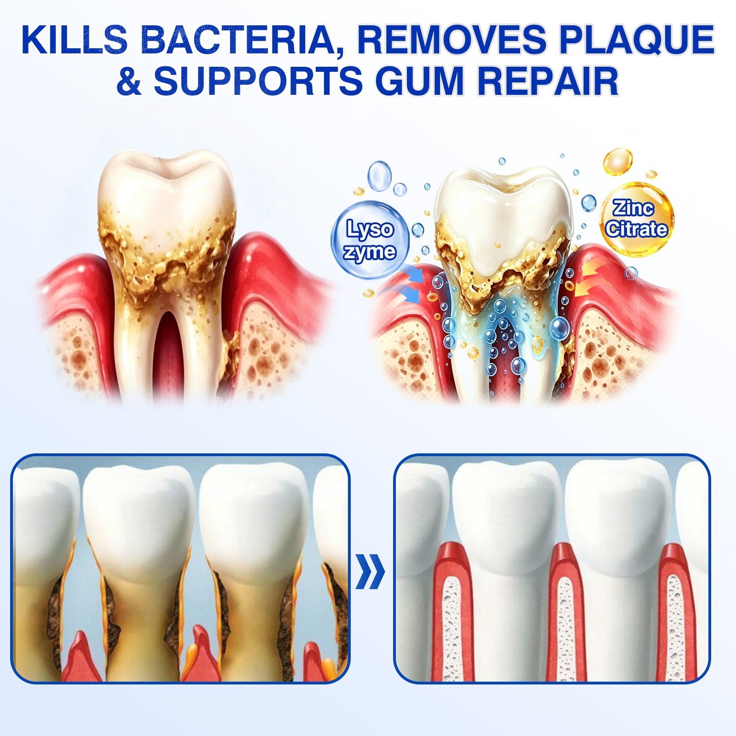 us👨‍⚕️✅🦷 Moragoon® Gum Protect Periodontal Repair Gel