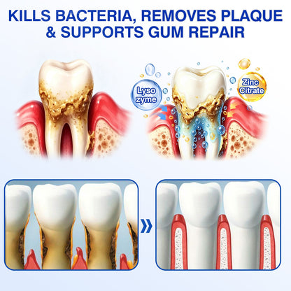 us👨‍⚕️✅🦷 Moragoon® Gum Protect Periodontal Repair Gel