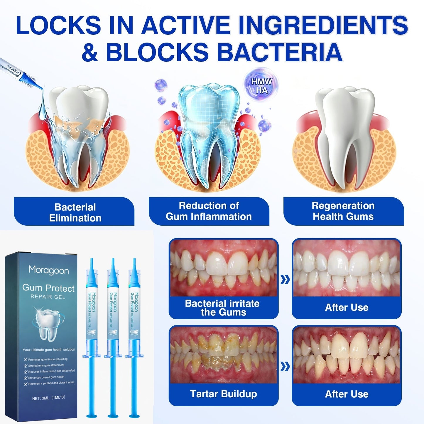 us👨‍⚕️✅🦷 Moragoon® Gum Protect Periodontal Repair Gel