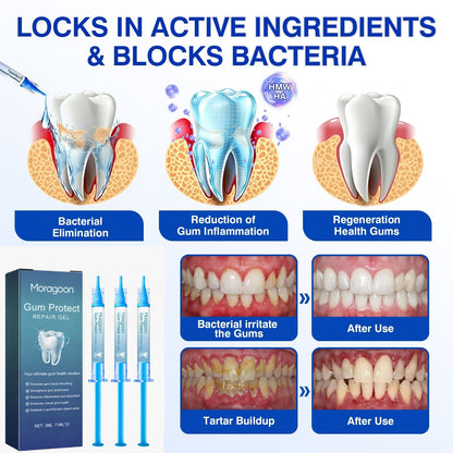 us👨‍⚕️✅🦷 Moragoon® Gum Protect Periodontal Repair Gel