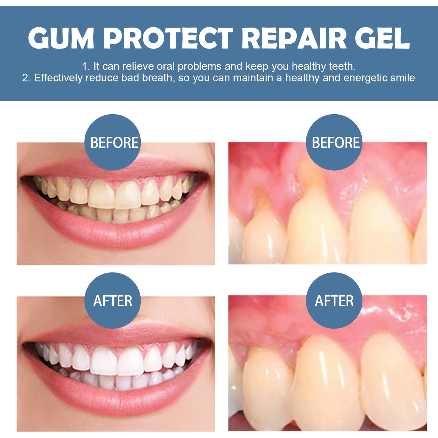 📢📢Moragoon™ Gum Repair Gel – Deep Clean Oral Care for Healthy Gums & Fresh Breath